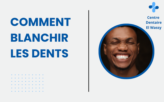 Comment Blanchir Les Dents