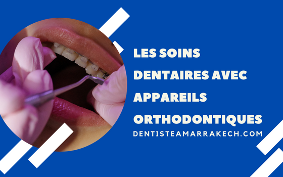 Les Soins dentaires avec appareils orthodontiques